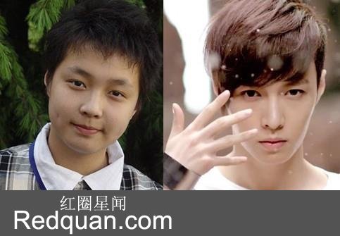 张艺兴整容前后照片被粉丝骂哭怎么回事 张艺兴女友是李琪琪吗(2)